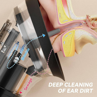 Ear Wax Removal
